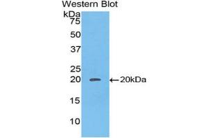 Western blot analysis of the recombinant protein. (Caspase 8 anticorps  (AA 25-175))