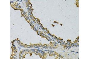 Immunohistochemistry of paraffin-embedded Human prostate using RPLP0 Polyclonal Antibody at dilution of 1:100 (40x lens). (RPLP0 anticorps)