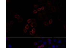 Immunofluorescence analysis of HeLa cells using FLNA Polyclonal Antibody at dilution of 1:100 (40x lens). (Filamin A anticorps)