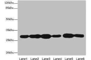 Western blot All lanes: PMM2 antibody at 3. (PMM2 anticorps  (AA 1-246))