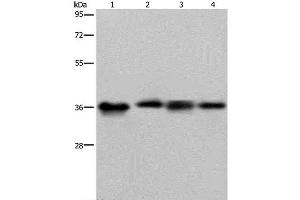 Western Blot analysis of HepG2 and 293T cell, Human kidney cancer tissue and K562 cell using JAM-A Polyclonal Antibody at dilution of 1:500 (F11R anticorps)