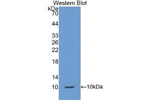 Western blot analysis of the recombinant protein. (S100A12 anticorps  (AA 1-92))