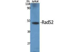 Western Blot (WB) analysis of specific cells using Rad52 Polyclonal Antibody. (RAD52 anticorps  (Thr56))