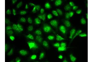 Immunofluorescence analysis of A549 cell using BIRC2 antibody. (BIRC2 anticorps)