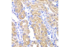Immunohistochemistry of paraffin-embedded rat kidney using ALDH2 antibody. (ALDH2 anticorps)
