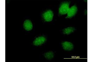 Immunofluorescence of  purified  MaxPab antibody to CBX6 on HeLa cell. (CBX6 anticorps  (AA 1-412))