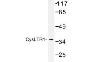 Image no. 1 for anti-Cysteinyl Leukotriene Receptor 1 (CYSLTR1) antibody (ABIN317699)