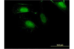 Immunofluorescence of monoclonal antibody to ZNF598 on HeLa cell. (ZNF598 anticorps  (AA 28-126))