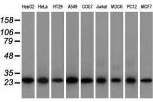 Western blot analysis of extracts (35 µg) from 9 different cell lines by using anti-EMG1 monoclonal antibody. (EMG1 anticorps)