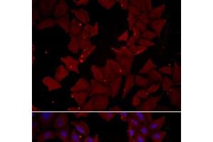 Immunofluorescence analysis of HeLa cells using CCT4 Polyclonal Antibody (CCT4 anticorps)