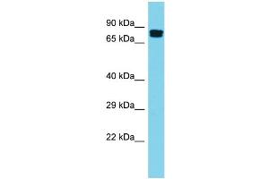 Host: Rabbit Target Name: GGA2 Sample Type: Placenta lysates Antibody Dilution: 1. (GGA2 anticorps  (N-Term))