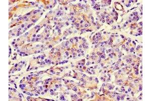 Immunohistochemistry of paraffin-embedded human pancreatic tissue using ABIN7159746 at dilution of 1:100 (MAP1 anticorps  (AA 401-600))