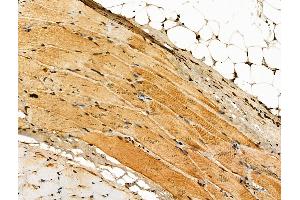 Phospho-VEGFR3 (Tyr1230) Antibody at 1/100 staining Rat skin tissue by IHC-P. (FLT4 anticorps  (pTyr1230))