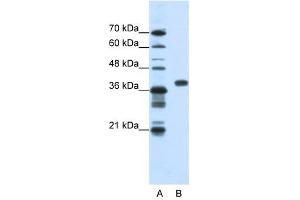 PCBP1 antibody used at 1. (PCBP1 anticorps)