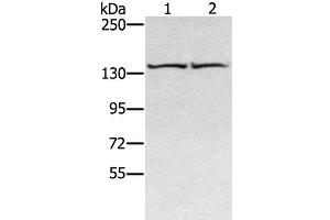 Western Blot analysis of Hela and hepg2 cell using RGS22 Polyclonal Antibody at dilution of 1:400 (RGS22 anticorps)