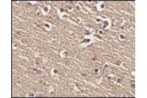Immunohistochemistry of Slitrk1 in human brain tissue with this product at 2. (SLITRK1 anticorps  (C-Term))