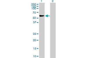 Western Blot analysis of TRIM46 expression in transfected 293T cell line by TRIM46 MaxPab polyclonal antibody. (TRIM46 anticorps  (AA 1-498))