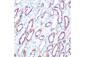 Immunohistochemistry of paraffin-embedded mouse kidney using iNOS antibody (ABIN6129509, ABIN6144728, ABIN6144730 and ABIN6218243) at dilution of 1:100 (40x lens).