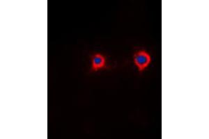 Immunofluorescent analysis of NFAT4 (pS165) staining in HeLa cells.