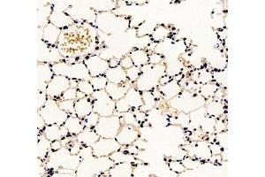 Immunohistochemistry of paraffin embedded mouse lung using groucho (ABIN7075961) at dilution of 1:2000 (300x lens) (TLE1 anticorps)