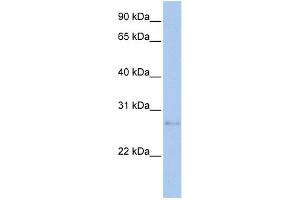 WB Suggested Anti-MDM1 Antibody Titration:  0. (MDM1 anticorps  (N-Term))