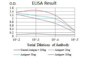 Black line: Control Antigen (100 ng), Purple line: Antigen(10 ng), Blue line: Antigen (50 ng), Red line: Antigen (100 ng), (ASS1 anticorps)