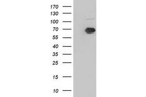 Western Blotting (WB) image for anti-Insulin-Like Growth Factor 2 mRNA Binding Protein 2 (IGF2BP2) antibody (ABIN1498825) (IGF2BP2 anticorps)