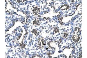 Image no. 2 for anti-FBJ Murine Osteosarcoma Viral Oncogene Homolog B (FOSB) (AA 240-289) antibody (ABIN202278)