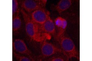 Immunofluorescence staining of methanol-fixed MCF cells using Phospho-KDR-Y1175 antibody. (VEGFR2/CD309 anticorps  (pTyr1175))