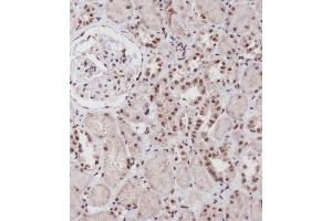Immunohistochemical analysis of (ABIN656884 and ABIN2846084) on paraffin-embedded Human kidney tissue was performed on the Leica®BOND RXm. (SIM1 anticorps  (N-Term))