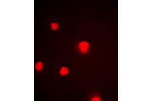 Immunofluorescent analysis of p53 (pS392) staining in HeLa cells. (p53 anticorps  (C-Term, pSer392))