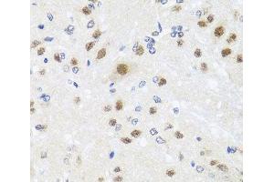 Immunohistochemistry of paraffin-embedded Rat brain using CETN3 Polyclonal Antibody at dilution of 1:100 (40x lens).