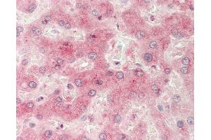 Human Liver: Formalin-Fixed, Paraffin-Embedded (FFPE).