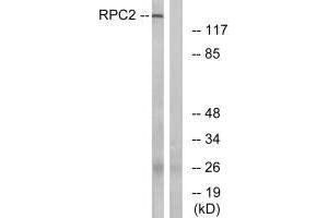Western blot analysis of extracts from LOVO cells, using RPC2 antibody. (POLR3B anticorps)