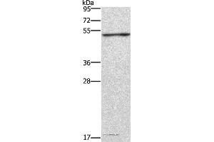 Western blot analysis of Jurkat cell, using CKMT2 Polyclonal Antibody at dilution of 1:700 (CKMT2 anticorps)