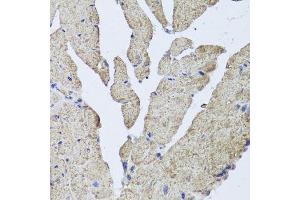 Immunohistochemistry of paraffin-embedded mouse heart using HBA2 antibody.