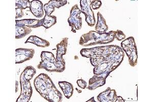 IHC analysis of ANXA4 using anti-ANXA4 antibody (ABIN5518805). (Annexin IV anticorps  (Middle Region))