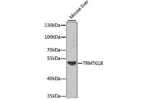 Western blot analysis of extracts of mouse liver, using TRMT61B antibody. (TRMT61B anticorps  (AA 1-250))