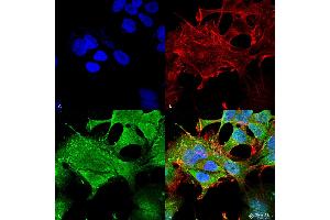Immunocytochemistry/Immunofluorescence analysis using Mouse Anti-Notch1 Monoclonal Antibody, Clone S253-32 .
