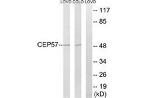 Western blot analysis of extracts from COLO/LOVO cells, using CEP57 Antibody. (CEP57 anticorps  (AA 241-290))