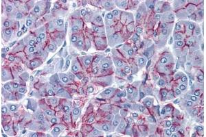 Human Pancreas: Formalin-Fixed, Paraffin-Embedded (FFPE)