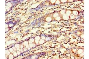 Immunohistochemistry of paraffin-embedded human colon tissue using ABIN7157727 at dilution of 1:100