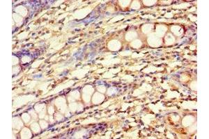 Immunohistochemistry of paraffin-embedded human colon tissue using ABIN7157727 at dilution of 1:100 (KLF4 anticorps  (AA 30-230))