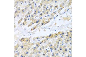 Immunohistochemistry of paraffin-embedded human liver using CCL3 antibody at dilution of 1:100 (40x lens).