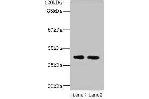 Western blot All lanes: DNALI1 antibody at 1 μg/mL Lane 1: Mouse gonadal tissue Lane 2: Mouse lung tissue Secondary Goat polyclonal to rabbit IgG at 1/10000 dilution Predicted band size: 30, 16 kDa Observed band size: 30 kDa (DNALI1 anticorps  (AA 1-258))
