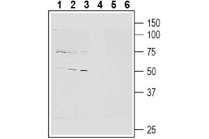 anti-Cannabinoid Receptor 2 (CNR2) (AA 228-242) antibody