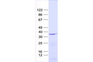 Validation with Western Blot