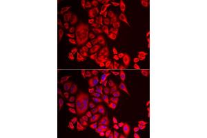 Immunofluorescence analysis of MCF-7 cell using QPCT antibody. (QPCT anticorps)