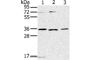 Western blot analysis of SP20, Raji and 231 cell, using IL22RA2 Polyclonal Antibody at dilution of 1:200