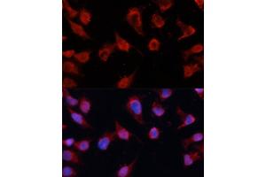 Immunofluorescence analysis of HeLa cells using Caspase-8 antibody (ABIN6131531, ABIN6137971, ABIN6137973 and ABIN6215162) at dilution of 1:100. (Caspase 8 anticorps)